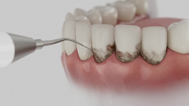 Trusted Teeth Cleaning And Checkup service in Thorntown, IN - Dentist Open Now